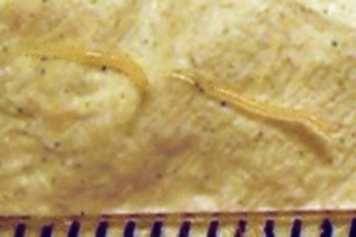 Two female pinworms next to a ruler. (Source: Wikipedia)