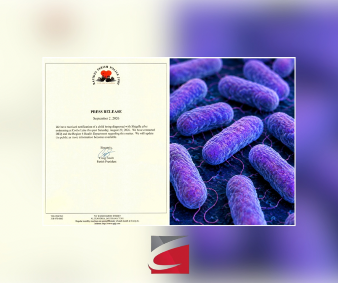 Child Diagnosed With Shigella After Swimming at Cotile Lake; Parish Contacts State Agencies (Illustration of Shigella bacteria)